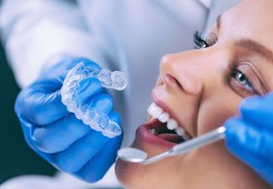 Combien Coûte le Blanchiment des Dents?