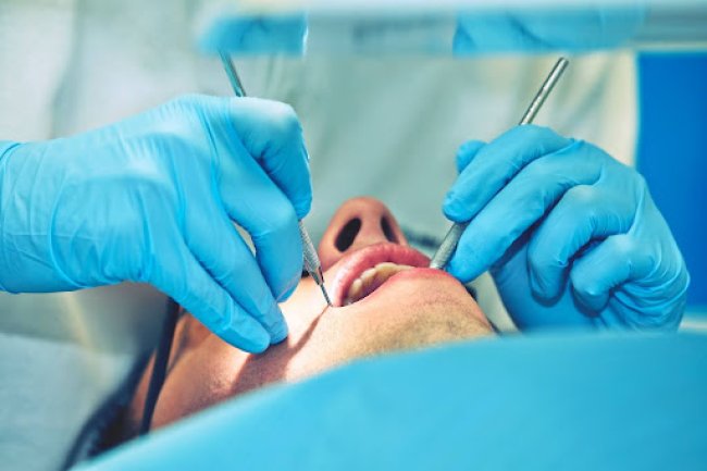 Greffe Gingivale : Combien Ça Coûte et Quels Facteurs Influencent le Prix? 